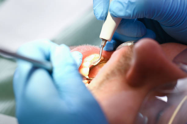 Best Pediatric Emergency Dentist in Tappan, NY